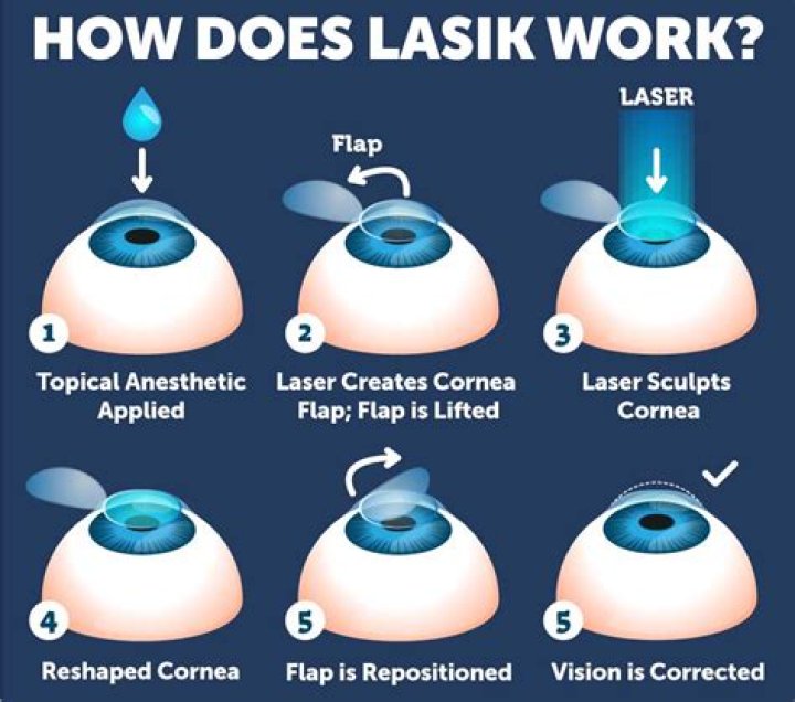 Is Lasik Scary Is Lasik Scary